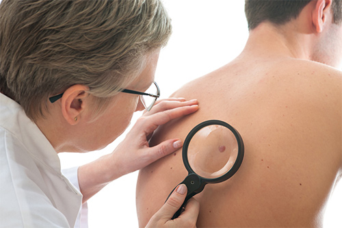 prevent-skin-cancer-img-1588668922